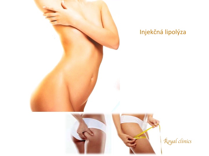 Injekn lipolza